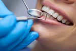تعرفه جدید دندانپزشکی ۱۴۰۱ اعلام شد + جزئیات
