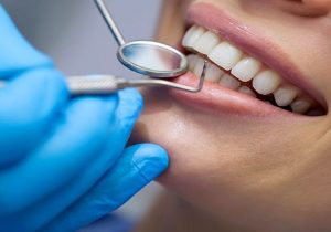 تعرفه جدید دندانپزشکی ۱۴۰۱ اعلام شد + جزئیات